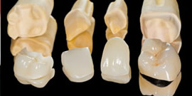 セラミック治療歯科材料