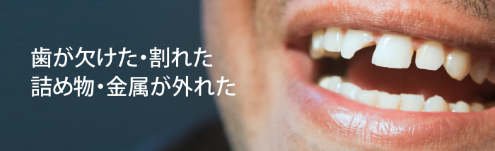 歯が欠けた・割れた