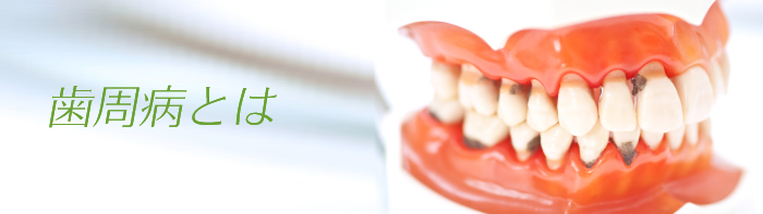歯周病とは